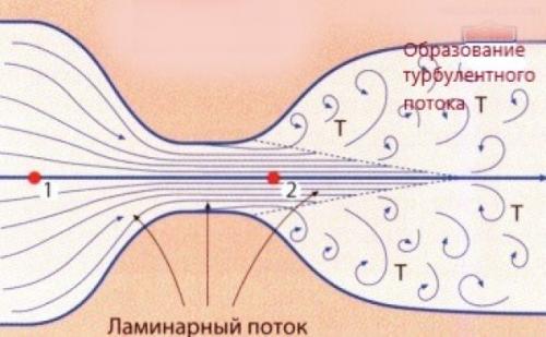 Как уменьшить шум воды в трубах. Почему гудит водопровод и чем это грозит